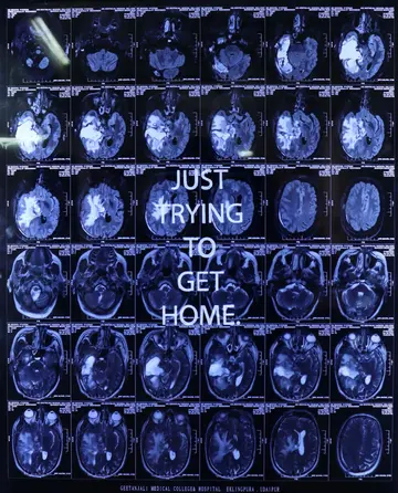 Scan of a memory I by Diya Mehta - Text scratched on MRI films and lightboxes
