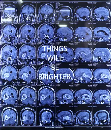 Scan of a memory I by Diya Mehta - Text scratched on MRI films and lightboxes