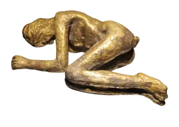 Anxiety by Aditi Suneja - Bronze