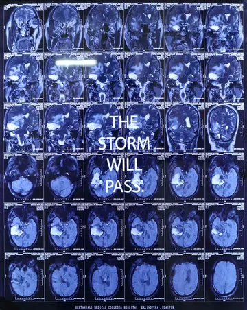 Scan of a memory I by Diya Mehta - Text scratched on MRI films and lightboxes